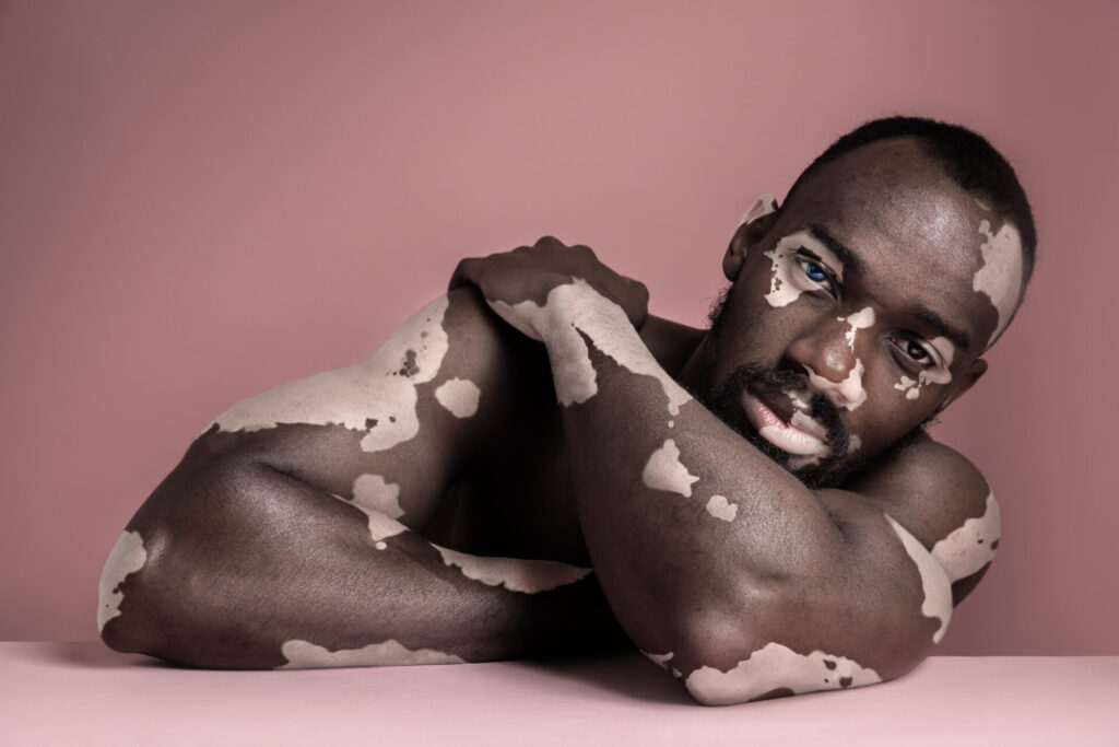 Close,Up,Fashion,Portrait,Of,A,Male,Afro,Or,African